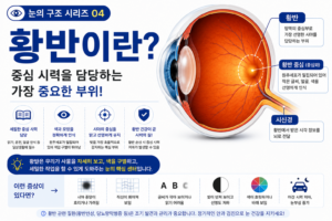 황반 썸네일